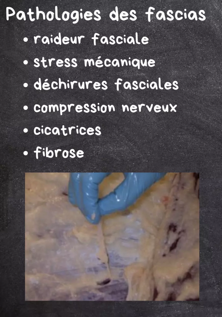 pathologies des fascias equine mind body