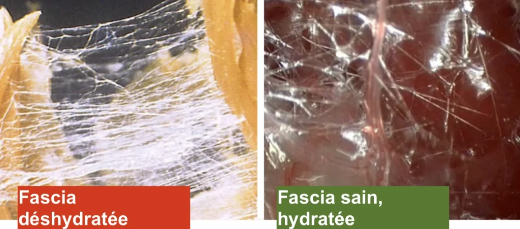 fascia sain et déhydrate humain 